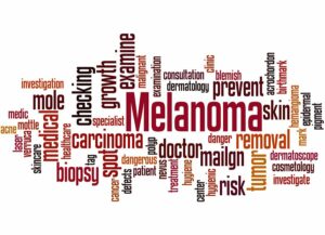 Home Care Services Dix Hills NY - You and Home Care Services Learn Melanoma Signs