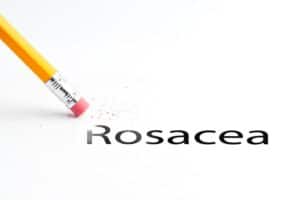 Home Care Northport NY - Coping with Rosacea